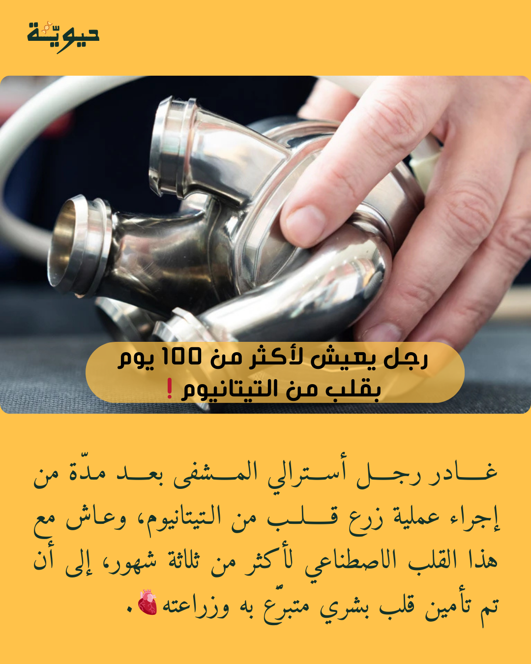 رجل يعيش لأكثر من ١٠٠ يوم بقلب من التيتانيوم