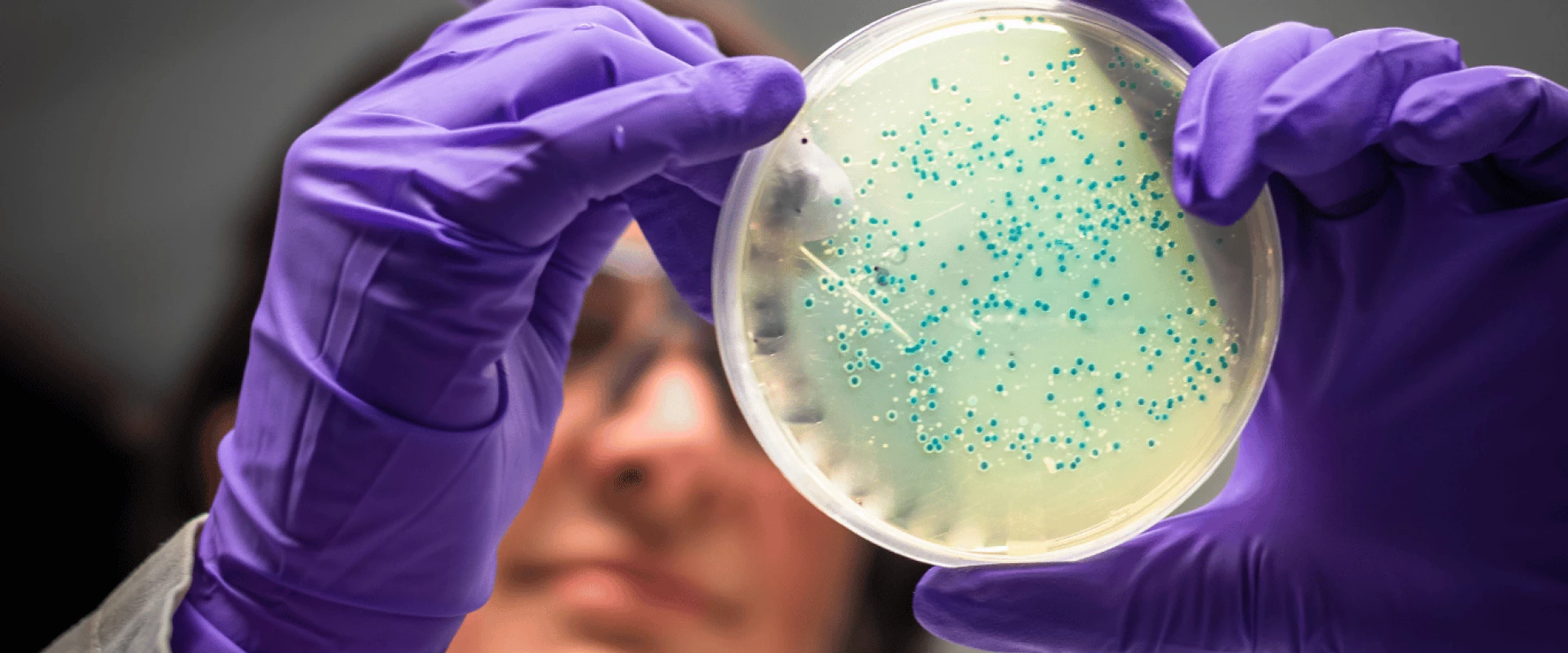 هل تحمي بكتيريا الأمعاء أجسامنا من سمّية المبيدات؟